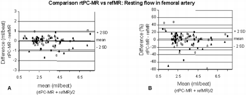 Figure 4. Reproducibility for peak hyperemic flow per minute (at a heart rate of 60 bpm) for 100mL of lower leg volume is high.