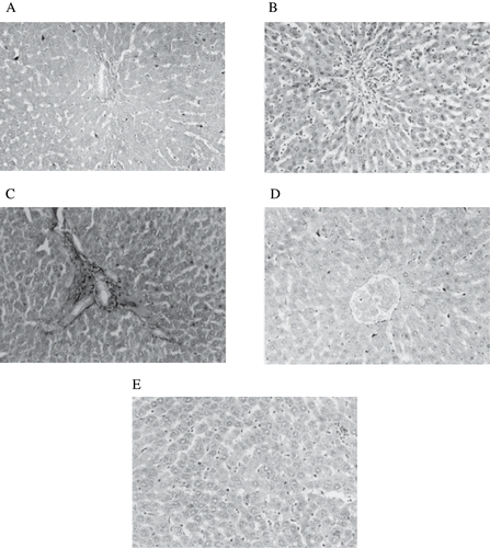 Figure 10. Figure A: Control rat liver: H&E × 20; normal architecture of liver. Figure B: Diabetic treated rat liver: H&E × 20; inflammatory infiltration filling over the sinusoidal vacuolation of hepatocytic nuclei. Figure C: Diabetic treated rat liver: H&E × 20; portal triad with mild inflammation and cell infiltration. Figure D: Diabetic + THC treated rat liver: H&E × 20; near normal appearance of hepatocytes. Figure E: Diabetic + curcumin treated rat liver: H&E × 20; near normal appearance with mild changes in hepatocytes.