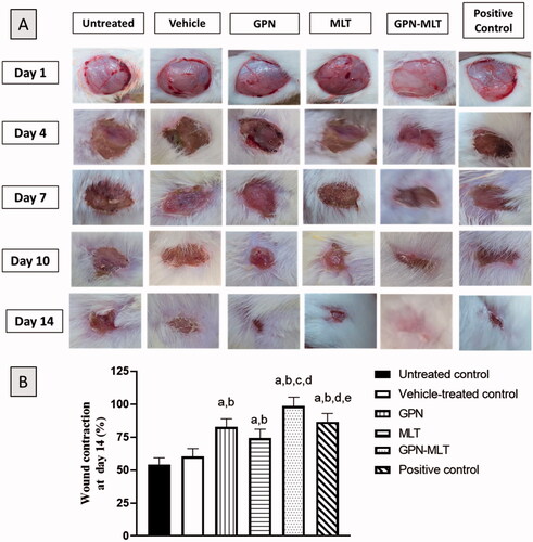 Figure 2. Effects of GPN, MLT, GPN-MLT nanoconjugate and marketed formulation on the wound contraction and % wound contraction on day 14. (a) Significantly different from Untreated control at p < .05, (b) Significantly different from Vehicle-treated control at p < .05, (c) Significantly different from GPN at p < .05, (d) Significantly different from MLT at p < .05, (e) Significantly different from GPN-MLT at p < .05.