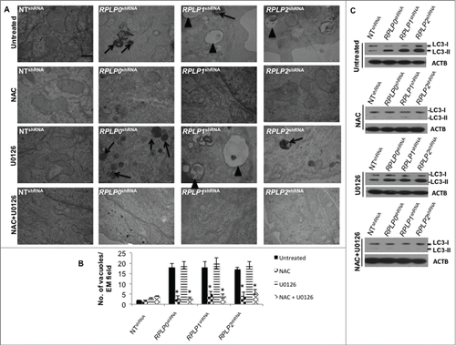 Figure 8. ROS-mediated autophagy in MCF-7 cells with downregulated RPLP proteins. (A) TEM analysis of MCF-7 cells expressing RPLP0 shRNA, RPLP1 shRNA, RPLP2 shRNA, or NT shRNA vector, untreated or treated with 20 mM NAC, 10 µM U0126, or NAC plus U0126, as described in the Materials and Methods section. The lack of signs of autophagy such as autophagosomes (arrowheads) and autolysosomes (black arrows) are features of RPLP0 shRNA, RPLP1 shRNA, and RPLP2 shRNA samples treated with NAC, an ROS scavenger. Scale bar: 0.5 μm. (B) Quantifications are based on counting autophagic vacuoles in the field of view. The values are the mean ± S.D. of 3 independent experiments. *, P ≤ 0.05. (C) Western blot analysis of the LC3-II conversion form compared with ACTB in samples treated as in (A).