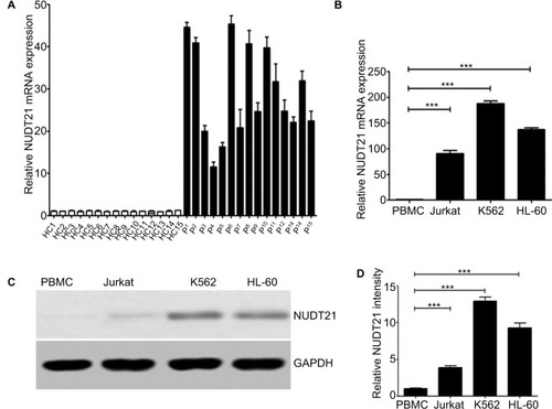 Figure 1 Expression levels of NUDT21 in human leukemia.Notes: (A) mRNA expression levels of NUDT21 in bone marrow samples from healthy control subjects (HC1–HC15) and CML patients (P1–P15). The mRNA (B) expression levels of NUDT21 were evaluated by qRT-PCR in human normal PBMCs, human leukemia cells K562, Jurkat, and hl-60 cells. The protein (C and D) expression levels of NUDT21 were evaluated by Western blotting in human normal PBMCs, human leukemia cells K562, Jurkat, and hl-60 cells. GAPDH was used as internal control; the data are the mean ± SD for duplicate experiments. ***P< 0.001.Abbreviations: CML, chronic myelocytic leukemia; HC, healthy control; qRT-PCR, quantitative reverse polymerase chain reaction.