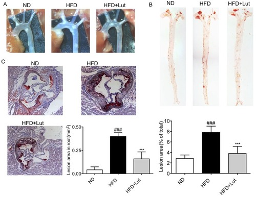 Figure 2 Luteolin administration prevented atherosclerotic plaque development in HFD-fed ApoE−/− mice.