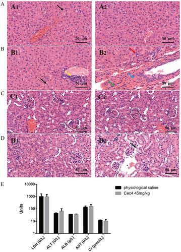 Figure 5 Acute toxicity assessment of Cec4 in mice. (A) Histopathological observation of liver tissues of mice injected with normal saline. Black arrows indicate steatosis of hepatocytes (A1 and A2 are different fields of view in the same slice, the same applies below). (B) Histopathological observation of liver tissue of mice injected with Cec4. Black arrows indicate loose hepatocyte cytoplasm, yellow arrows indicate focal infiltration of a few lymphocytes, red arrows indicate bile duct hyperplasia, blue arrows indicate connective tissue hyperplasia, and green arrows indicate hemosiderin exudation. (C) Histopathological observation of renal tissue of mice injected with normal saline. (D) Histopathological observation of renal tissue in mice injected with Cec4, the black arrow indicates eosinophilic material in the renal vesicles. (E) Blood biochemical assays of mouse for C9 (45 mg/kg) treated 24 h. Serum levels of lactate dehydrogenase (LDH), alanine aminotransferase (ALT), aspartate aminotransferase (AST), albumin (ALB), and serum creatinine (Cr) were determined. Data are presented as mean ± SD (n = 6) and the statistical analysis was assayed by the independent Student’s t test (P > 0.05).