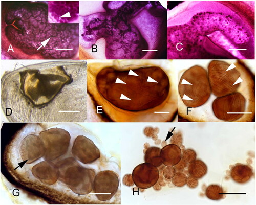 Figure 7. Synophrya whole mount life cycle stages from Achelous spinimanus (A-D) and Pandalus borealis (E-H) from the Atlantic coast. A. A hypertrophont with a healthy macronuclear reticulum (dark cords at arrow). Inset: cyst filled with hypertomites, revealing solid macronuclei (arrowhead). B. Degenerating macronucleus in a hypertrophont isolated by a melanin reaction. C. Final stages of macronuclear degeneration. D. Whole mount gill lamella with a wildly shaped hypertrophont, surrounded by the host’s reaction. E. Undivided hypertrophont stage revealing dark thin lines of the sparce ciliary rows (arrowheads). F. Divisional stages showing ciliary rows (arrowheads). G. Divisional stages with large macronuclear cords (arrow). H. Final stages of division with many divisional products, from a dissected specimen. The smallest cells are the hypertomites (arrow). A-C. Hematoxylin. D. Unstained. E-H. Silver nitrate. Scale bars 100 µm (A-C, E-H), 500 µm (D). Figure H used with permission from Lee et al. Citation2019. The remaining figures are new.
