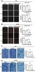 Figure 4 MiR-4665-3p inhibits migration and invasion of gastric cancer cells.
