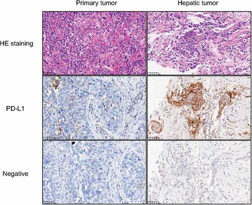 Figure 2. Hematoxylin-Eosin (HE) staining and immunohistochemistry of tumors.