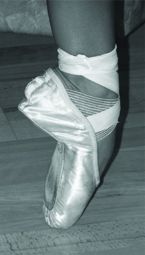 Figure 1 A ballet dancer standing en pointe. Note the extreme talocrural plantar flexion and the architecture of the midfoot, the combination of which is required for the dancer to attain this position.