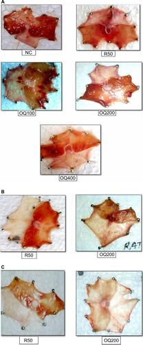 Figure 1 (A) Pyloric ligation method: single-dose study. (B) Pyloric ligation method: 10 days of pretreatment or repeated-dose study. (C) Pyloric ligation method: 20 days of pretreatment or repeated-dose study.Notes: As shown in (A), the extract at the highest dose (OQ400) demonstrated better effects than the standard drug (R50) in terms of percent inhibition of ulcer score and ulcer index. (B and C) demonstrate that the extract 200 mg\kg dose possess better anti-ulcer effect when taken repeatedly.Abbreviations: OQ, Osyris quadripartita; NC, negative control; R50, ranitidine 50 mg/kg; OQ100, 100 mg/kg of extract; OQ200, 200 mg/kg of extract; OQ400, 400 mg/kg of extract.