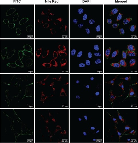 Figure 4 CLSM images of FR-positive EMT6 cells and FR-negative L929 cells after incubation with Nile Red-loaded LPNPs and FLPNPs for 2 h.Notes: Row 1 and 2: EMT6 cells were used. Row 3 and 4: L929 cells were used. In row 1 and 3, LPNPs were used while in row 2 and 4, FLPNPs were used.Abbreviations: FITC, fluorescein isothiocyanate; CLSM, confocal laser scanning microscopy; FR, folate receptor; LPNPs, lipid–polymer hybrid nanoparticles; FLPNPs, folate modified lipid-shell and polymer-core nanoparticles; h, hours.