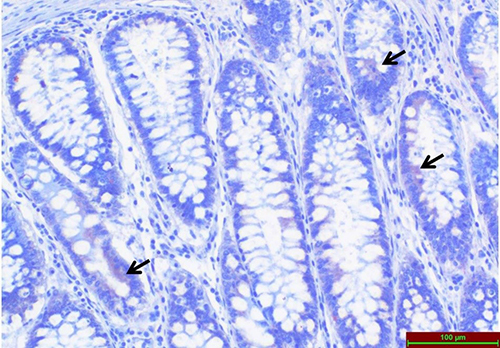 Figure 5 Light microscopic examination of TRPC1 immunoreactivity immunohistochemical staining in normal colon tissues. Arrows indicate areas of immunohistochemical staining.