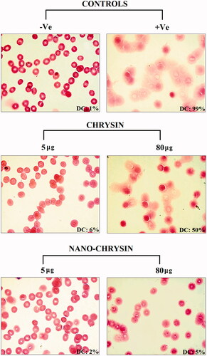 Figure 7. Light microscope images of RBCs treated with two concentrations (5 and 80 μg mL−1) of original pure chrysin and modified nanochrysin loaded in PLGA-PVA. Percentage of total number of defective cells (DC) is indicated.