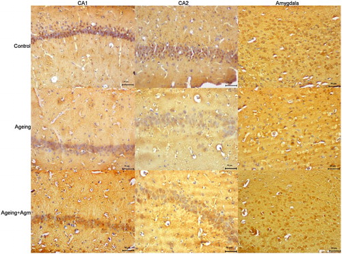 Figure 3. Representative image illustrating BDNF expression (arrows) in hippocampal formation. Control (a), 24-month (b) and 24-month + agmatine (c) groups in the CA1 region, and control (d), 24-month (e) and 24-month + agmatine (f) groups in the CA3 region. control (g), 24 month (h) and 24-month + agmatine (i) groups in the amygdala. BDNF expression was decreased in 24 month in the CA1 and CA3 regions of the hippocampus, and amygdala, whereas in 24-month + agmatine rats BDNF expression was similar to those in the control group in the all regions. Scale bars: 50 μm.