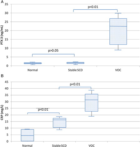 Figure 1. (A) Levels of PTX3 are comparable in normal controls and stable SCD patients, whereas they are significantly increased in VOC (P < 0.01). (B) Levels of CRP are increased in stable SCD compared to controls (P < 0.01), with a further increment in VOC (P < 0.01). The box and whisker plots show in the box the median and the 25th and 75th percentile; whiskers show the 2.5th and 97.5th percentile.