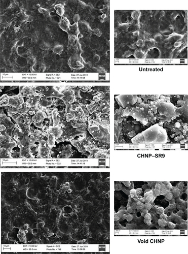 Figure S4 Scanning electron microscopy (SEM) confirmed disruption in monolayer of CHNP–SR9-treated cells. The SEM images of the membranes confirmed a significant damage to the Caco-2 monolayer in CHNP–SR9-treated cells, whereas no damage was observed in untreated or void CHNP-treated cells. This illustrates that SR9 was highly cytotoxic to the cancerous cells, whereas the void CHNP showed no significant cytotoxicity on the Caco-2 cells.Abbreviations: CHNP, chitosan nanoparticle; SEM, scanning electron microscopy; SR9, cell-permeable dominant negative survivin SurR9-C84A; EHT, extra high-tension electrical voltage; WD, working distance; Caco-2, colorectal adenocarcinoma cells.