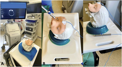 Figure 1. StealthStationTM S8 electromagnetic image-guided navigation system illustrative set-up. (A) represents the placement of the flat emitter under standard supportive headrests, with the display console at the head end. (B) displays the adhesive reference tracker on the patient’s forehead, and the use of the navigation pointer to complete surface-based registration. (C) demonstrates a side view of this low-profile ergonomic system.