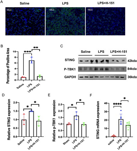 Figure 3. H-151 inhibits the activation of the STING–TBK1 signaling pathway. (A, B) Immunofluorescence staining was performed to assess the positive area percentage of STING protein in kidney tissue sections. (C–E) Western blot analysis was conducted to evaluate the expression of STING and p-TBK1 in mouse kidneys after intraperitoneal injection of H-151, with normalization to GAPDH. (F) Quantitative real-time PCR analysis was carried out to determine the gene expression of STING in kidney tissue. *p < .05, **p < .01, and ***p < .001.