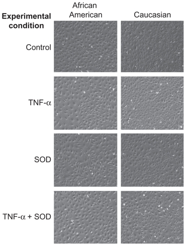 Figure 1 Representative images of African American and Caucasian HUVECs at harvest under all experimental conditions.