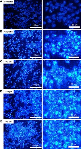 Figure 5 Images of DAPI staining of A2780 ovarian cancer cells.