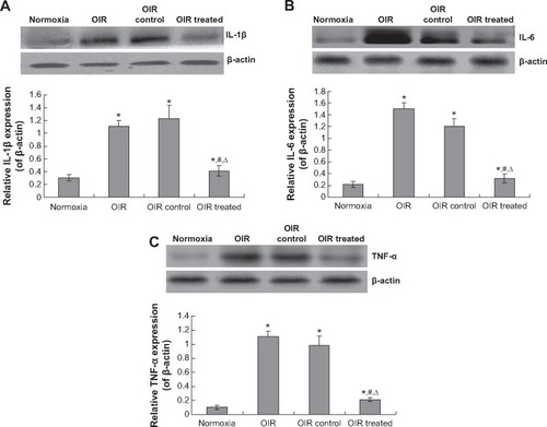 Figure 6 CCN1 siRNA decreases the inflammatory cytokines expression.