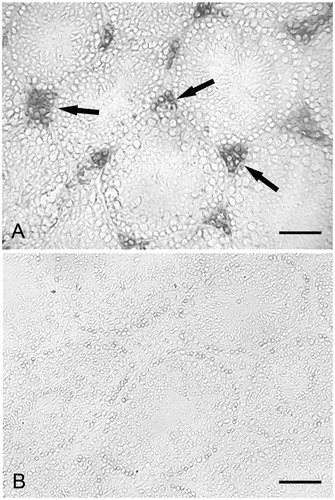 Figure 3. Calprotectin immunohistochemistry. (A) Alcohol treated mouse. Diffuse labeling is present in the interstitial cells (arrows). No labeling is found in the seminiferous tubules; scale bar: 60 µm. (B) Control mouse. Labeling is lacking, both in the seminiferous tubules and the interstitial cells; scale bar: 60 µm.