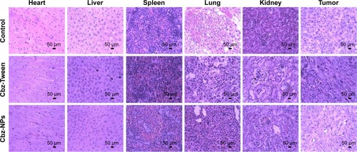 Figure 6 The pathological hematoxylin and eosin staining analysis of tissue sections.Note: Arrows were used to indicate relevant areas of fat liver and spleen infiltration.Abbreviation: Cbz-NPs, cabazitaxel-loaded human serum albumin nanoparticles.