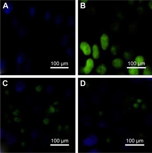 Figure 9 ROSexpression.Notes: (A–D) The islet tissues of Sham, I/R, phycocyanin and phycocyanin/PEG-b- (PG-g-PEI) groups of rats were collected 12 hours after reperfusion and the ROSexpression measured. The ROS expression is significantly higher in the I/R group than in the Sham group; the ROSexpression is lower in the phycocyanin group than in the I/R group; the ROS expression is significantly lower in the phycocyanin/P group than in the I/Rgroup.Abbreviations: PEG-b-(PG-g-PEI), poly(ethylene glycol)-b-(poly(l-glutamic acid)-g-polyethylenimine); ROS, reactive oxygen species.