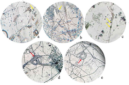 Figure 2. Photograph of interaction zones between Trichoderma and phytopathogenic strains after 10 days of incubation seen at a light microscope. A. Trichoderma atroviride LBM 112 interaction with A. alternata LBM 186 (40X); B. Trichoderma koningiopsis LBM 116 interaction with C. gigasporum LBM 184 (40X); C. Trichoderma stilbohypoxyli LBM 120 confronted with Phoma sp. LBM 207 (10X); D. Trichoderma koningiopsis LBM 219 confronted with Phoma sp. LBM 207 and E. Trichoderma koningiopsis LBM 219 confronted with F. oxysporum LBM 183 (10X). Yellow arrows show Trichoderma spores around pathogen hyphae and red arrows indicate the circular winding between T. koningiopsis LBM 219 and phytopathogens.