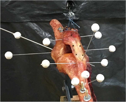Figure 1. Experimental set-up to achieve traction on the tendon of the femoral quadriceps and markers to follow 3 D movements.