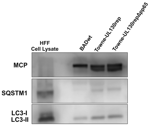 Figure 4. Lipidated LC3 is present in purified viral particles. Western blot analysis of whole-cell lysates of uninfected HFF and 30 µg of purified virions, respectively, and probed with antibodies against MCP, SQSTM1, and LC3B. Three different laboratory strains were tested. Only the lipidated form of LC3, LC3-II, was found in HCMV virions