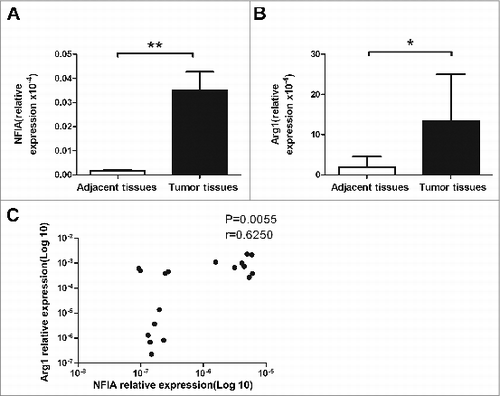 Figure 6. High level of NFIA in human lung cancer tissue. NFIA expression (A) and Arg1 expression (B) of tumor and adjacent tissues from lung cancer patients were detected by qRT-PCR. (C) Correlation of the expression of NFIA and Arg1 in tumor tissue from lung cancer patients. **p < 0.01, *p < 0.05.