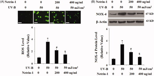 Figure 3. The UNC5b agonist netrin-1 attenuates ultraviolet-B (UV-B) exposure-induced oxidative stress in ESCs. ESCs were preincubated with netrin-1 (200, 400 ng/ml) for 12 h, followed by treatment with UV-B at 50 mJ/cm2 for 8 h. (A) Intracellular ROS was determined by DCFH-DA; Scale bar, 100 μM; (B) Western blot analysis of NOX-4 (ANOVA:*, #, $, p < .001 vs previous column group, n = 4–5).