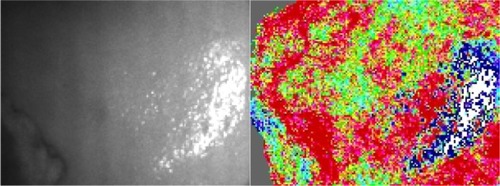 Figure 5 Laser speckle contrast image of human liver.