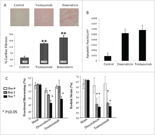 Figure 2. (A) Analysis of cardiac fibrosis (A1: representative photomicrographs of LV sections from mice treated with trastuzumab or doxorubicin; A2: quantification of interstitial fibrosis expressed as relative percentage). (B) TUNEL assay of cardiac tissue sections from mice treated with trastuzumab or doxorubicin. (C) effects on cardiac functions of doxorubicin or trastuzumab.Citation21,44.