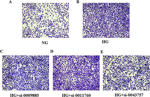 Figure 8 The effects of circRNAs on cell migration in HK-2 cells. (A) HK-2 cells were cultured under normal glucose (NG) and then cell migration assays were performed with transwell chambers. (B) HK-2 cells were cultured under high glucose (HG) and then cell migration assays were performed with transwell chambers. (C) HK-2 cells treated with high glucose (HG) were transfected with circ_0009885 siRNA and then cell migration assays were performed with transwell chambers. (D) HK-2 cells treated with high glucose (HG) were transfected with circ_0011760siRNA and then cell migration assays were performed with transwell chambers. (E) HK-2 cells treated with high glucose (HG) were transfected with circ_0043757 siRNA and then cell migration assays were performed with transwell chambers.
