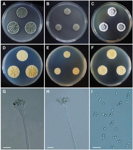 Figure 7. Morphology of Penicillium anthracinoglaciei CNUFC CY2234. (A, D) Colonies on Czapek yeast autolysate agar (CYA); (B, E) malt extract agar (MEA); (C, F) yeast extract sucrose agar (YES) (A–C: obverse view and D–F: reverse view); (G, H) Conidiophores; (I) Conidia. Scale bars= 20 µm.