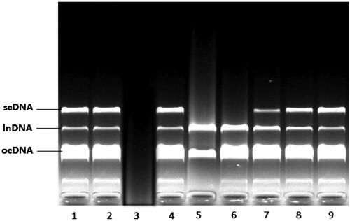 Figure 2. Electrophoretic pattern of pBR322 plasmid DNA after treatment with UV and H2O2 in the presence of Morus nigra aqueous extract. Addition of 0.02, 0.04, and 0.05 mg/mL M. nigra to the reaction mixture conferred the significant protection to the damage of all DNA bands; lanes 7, 8, and 9. Lane 1: plasmid DNA (3 μL) + dH2O (6 μL), lane 2: plasmid DNA (3 μL) + dH2O (6 μL) + UV, lane 3: plasmid DNA (3 μL) + dH2O (6 μL) + UV + H2O2 (1 μL), lane 4: plasmid DNA (3 μL) + dH2O (6 μL) + H2O2 (1 μL), lane 5: plasmid DNA (3 μL) + aqueous extract (0.005 mg/mL) (5 μL) + + UV + H2O2 (1 μL), lane 6: plasmid DNA (3 μL) + aqueous extract (0.01 mg/mL) (5 μL) + + UV + H2O2 (1 μL), lane 7: plasmid DNA (3 μL) + aqueous extract (0.02 mg/mL) (5 μL) + + UV + H2O2 (1 μL), lane 8: plasmid DNA (3 μL) + aqueous extract (0.04 mg/mL) (5 μL) + + UV + H2O2 (1 μL), lane 9: plasmid DNA (3 μL) + aqueous extract (0.05 mg/mL) (5 μL) + + UV + H2O2 (1 μL).