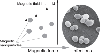 Figure 1 A simplified design for a magnetic drug delivery system in which magnetic nanoparticles coated with drugs are directed to infection sites by an external magnetic field.