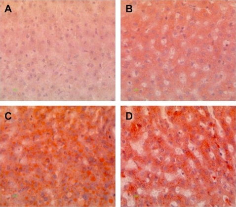 Figure 5 Oil red O staining of liver tissue from hamsters fed on hyperlipidemic diets. Magnification 400×. A) Normal diet, B) diet adequate in methionine and choline (5A4C), C) diet deficient in methionine and choline (5D4F), and D) diet adequate in methionine and deficient in choline (5D4E). Hamster hepatocytes are filled with microvesicular and/or macrovesicular fat deposits; they are depicted as reddish-orange deposits, as shown with Oil red O staining.