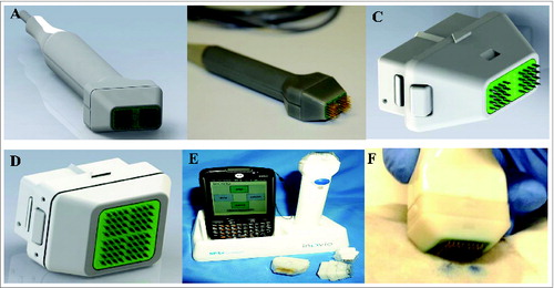 Figure 1. Multi-head device. (A) CAD concept drawing of multi-head hand piece. (B) Working prototype of 4 × 4 array with 1.5 mm spacing. (C) Close up of CAD concept disposable 2-head array (m2SEP). (D) Close up of CAD concept 4-disposable head array (m4SEP). (E) Wireless device in base station with Pocket PC displaying the user interface. (F) The m4SEP in use in a guinea pig model.