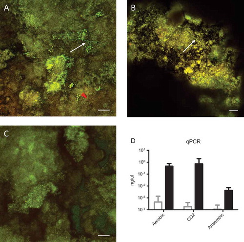 Figure 1. Confocal images of (a) aerobic biofilm, (b) aerobic +5% CO2 biofilm, and (c) anaerobic biofilm. White arrows indicate visible Candida albicans cells; the size bar indicates 25 µm. (d) Quantitative polymerase chain reaction (qPCR) data in ng/µL, where white bars are saliva biofilms and black bars are mixed biofilms. The differences in C. albicans presence between the saliva only and mixed inoculum were all significant (p < 0.05) within the same condition. C.albicans was integrated in the microcosm biofilm when O2 was available.