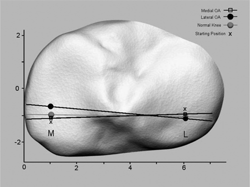 Figure 17. Reconstruction of the tibial plateau and the projections of the flexion facet centers between the reference position (x) and 45° (dot or square) are shown. The tibial plateau was reconstructed from CT data of a normal knee. In addition to data from control subjects and knees with lateral osteoarthritis (OA) the corresponding mean translations in 14 knees with medial OA (from Saari et al. 2005 are illustrated. As an effect of internal tibial rotation at 45° the medial femoral condylar center displaced anteriorly and the lateral one posteriorly (mean values) in control subjects and knees with lateral OA. In medial OA, the mean AP translations were small and in the opposite directions (posteriorly in medial compartment and anteriorly in the lateral one).