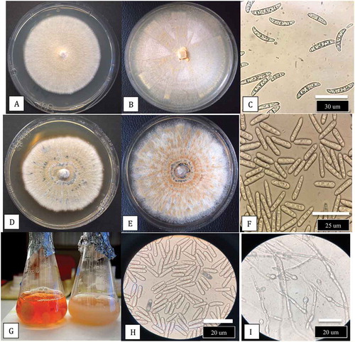 Fig. 9 (Colour online) Comparison of colony growth and spore production by Fusarium solani and F. lichenicola at 30°C. a, Growth of F. solani after 1 week. b, Growth after 2 weeks. c, Macroconidia of F. solani from culture. d, Growth of F. lichenicola after 1 week. e, After 2 weeks. f, Spores of F. lichenicola from culture. g, Growth of F. lichenicola (left) and F. solani (right) in potato dextrose broth (PDB) after 10 days. Note pigment production in latter species. h, Spores of F. lichenicola from PDB. i, Chlamydospores in PDB