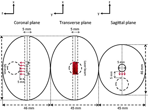 Figure 2. The generated walnut shape prostate model and the embedded spherical tumour from three different perspectives.