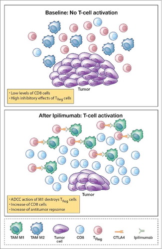 Figure 5. Model of tumor microenviroment (TME). Prior the ipilimumab treatment we have low levels of CD8 cells due to the inhibitory effect of Treg and powered by the pro tumor activity of tumor associated macrophages M2 (TAM M2). After treatment, we have a decrease of Treg, a change in TAM polarization that switch from M2 to M1, and a raise of CD8 cells that mediate an increase of antitumor response.