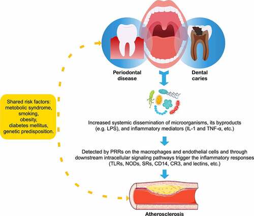Figure 3. Relationship between atherosclerosis and oral diseases