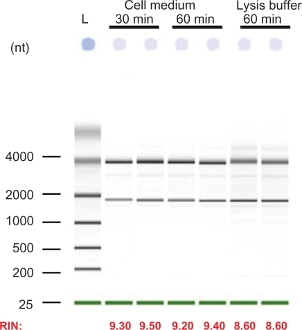 Figure 5 Total RNA extraction from HepG2 transfected cells with 10 pmol siRNA. Following transfection, cells were treated with chitosanase for: 30 min and 60 min in cell medium and for 60 min in lysis buffer.