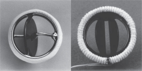Figure 1 Photographs of commonly used prosthetic valves. Left: single-tilting-disk (Medtronic-Hall, Medtronic, Minneapolis, MN) valve; Right: bileaflet-tilting-disk (St Jude Medical, Little Canada, MN) valve.