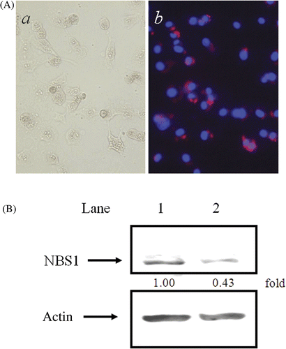 Figure 1. NBS1-siRNA transfection in 8305c cells. (A) Transfection efficiency of NBS1-siRNA: (a) phase microscope image; (b) DAPI staining with Cy3-labelled SEC1. (B) Effect of NBS1-siRNA transfection on the accumulation of NBS1 in 8305c cells. Constitutive expression of NBS1 and actin was analysed at 48 h after transfection of scrambled siRNA (lane 1) and NBS1-siRNA (lane 2). (C) The density of the accumulation of NBS1 in 8305c cells in Western blot analysis.