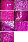 Figure 4 Histopathological alterations in liver tissue sections of rats in different groups. (A) Liver section of rat in the control group showing normal histology with normal central vein and hepatocytes arranged in the hepatic cords. (B–E) Liver sections of rats in the group that received 50 mg/kg Ch-AgNPs, showing: (B) diffuse hepatocellular vacuolar degeneration; (C) individual hepatocellular necrosis and apoptosis (arrow); (D) focal area of hemorrhage (arrow) in the hepatic parenchyma; (E) perihepatitis characterized by congestion (arrow), fibrin deposition (star) and inflammatory cells infiltration in the hepatic capsule together with hepatocellular vacuolar degenerations (arrowhead). (F) Liver of rat in the group that received 25 mg/kg Ch-AgNPs showing mild hepatocellular vacuolation with hyperactivation of Kupffer cells (arrow). (G) Liver of rat in the group that received 10 mg/kg Ch-AgNPs showing normal histology.Note: All sections stained by H&E.Abbreviation: Ch-AgNPs, chitosan-coated silver nanoparticles.