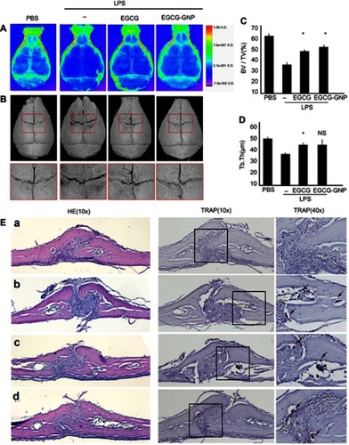 Figure 8 Administration of EGCG and EGCG-GNPs protected against LPS-induced mouse calvarial bone erosion in vivo. Mice were subcutaneously injected 1 day in advance and then 30 min before the daily LPS injection for 7 days. Finally, the mice were sacrificed, and calvariae were removed for fixation. (A) X-ray images. (B). Micro-CT reconstruction images. (C and D). Microarchitecture parameters assessed by micro-CT (*P<0.05). (E) Calvariae were fixed, decalcified, dehydrated, embedded, and sectioned. H&E staining (10×) and TRAP staining (10×, 40×) were performed for each group: (a) PBS, (b) LPS, (c) EGCG, and (d) EGCG-GNPs. Arrowheads indicate OCs. Abbreviations: LPS, lipopolysaccharides; H&E,  haemotoxylin and eosin; TRAP, tartrate-resistant acid phosphatase; PBS, phosphate buffered saline; OC, osteoclast; BV/TV, bone volume over total volume; Tb. Th, trabecular thickness.